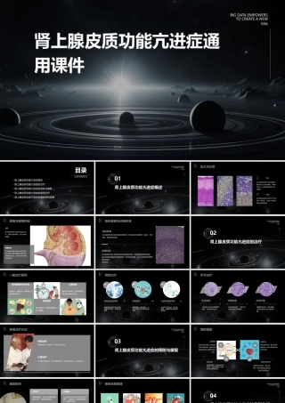 肾上腺皮质功能亢进症通用课件