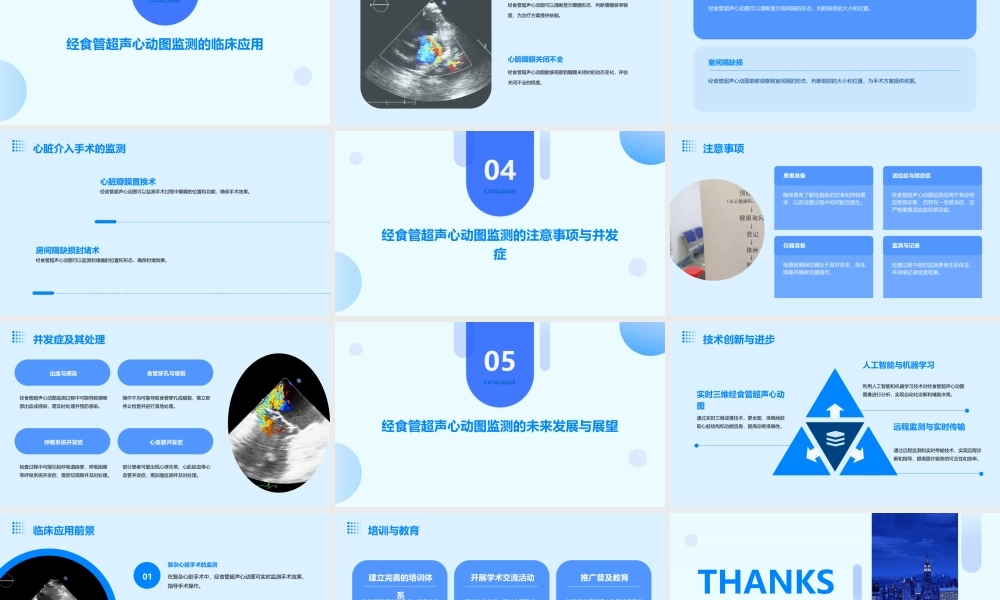 经食管超声心动图监测通用课件
