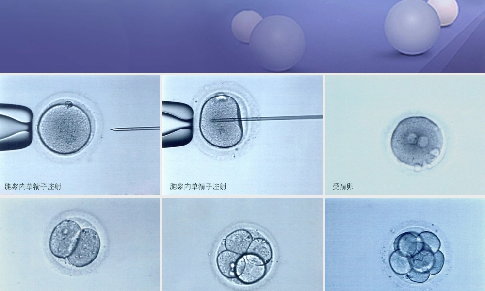 七年级生物下册 第四单元 生物圈中的人 第八章 人是生殖和发育 第一节 精卵结合孕育新的生命组图素材1(新版)苏教版 素材