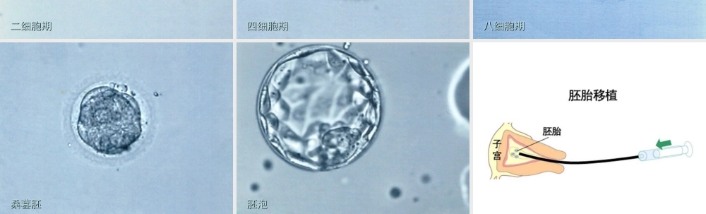 七年级生物下册 第四单元 生物圈中的人 第八章 人是生殖和发育 第一节 精卵结合孕育新的生命组图素材1(新版)苏教版 素材