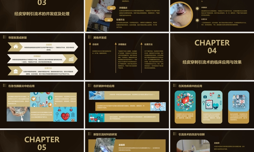 经皮穿刺引流术课件