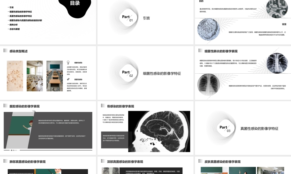 细菌性感染和真菌性感染的影像学差异课件