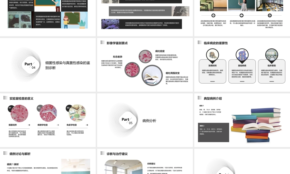 细菌性感染和真菌性感染的影像学差异课件