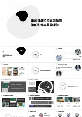 细菌性感染和真菌性感染的影像学差异课件