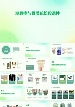 糖尿病与骨质疏松段课件
