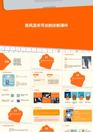类风湿关节炎的诊课件