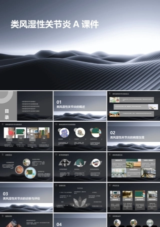 类风湿性关节炎A课件