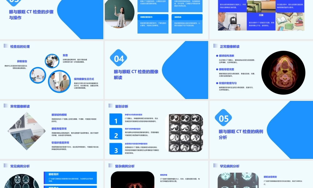 眼与眼眶CT检查课件