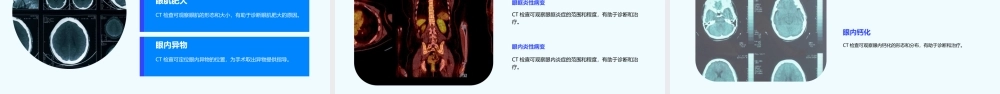 眼与眼眶CT检查课件