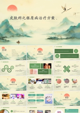 皮肤科之银屑病治疗方案