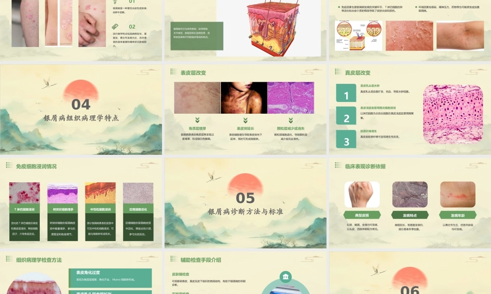 皮肤组织病理学之银屑病病理护理课件