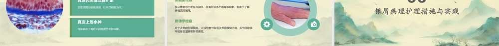 皮肤组织病理学之银屑病病理护理课件