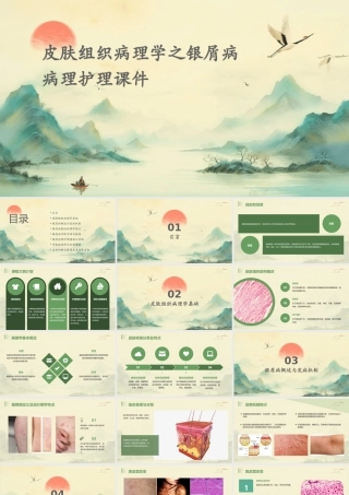 皮肤组织病理学之银屑病病理护理课件