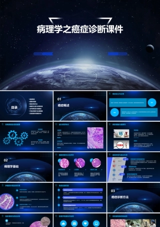 病理学之癌症诊断课件