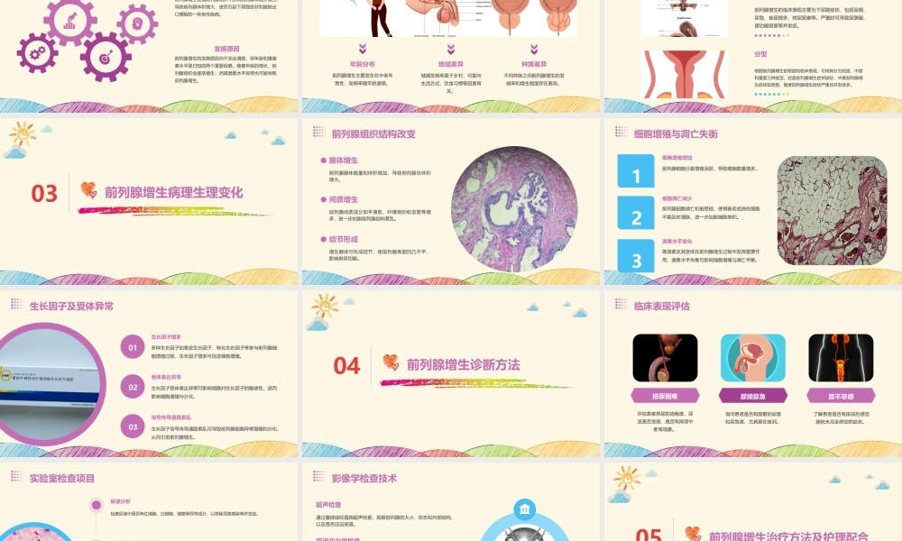 男科病理学之前列腺增生病理护理课件