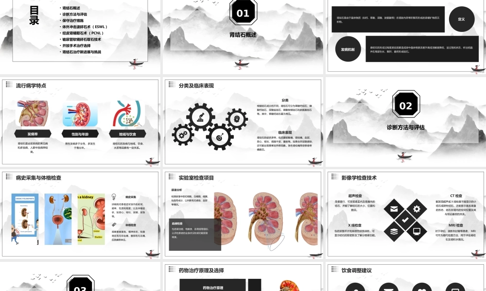 泌尿外科之肾结石治疗