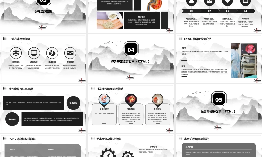 泌尿外科之肾结石治疗