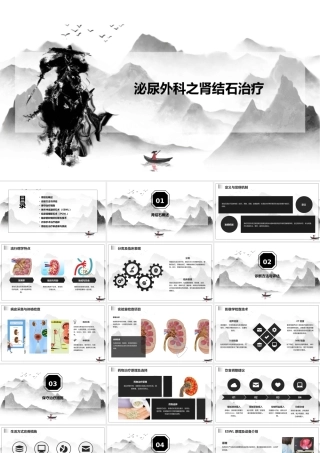 泌尿外科之肾结石治疗