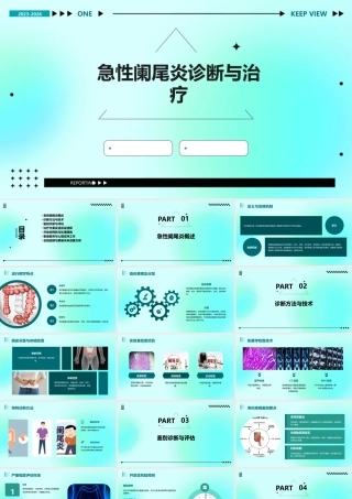 急性阑尾炎诊断与治疗