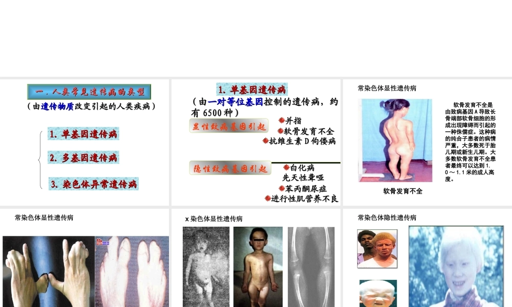 人类遗传病与优生