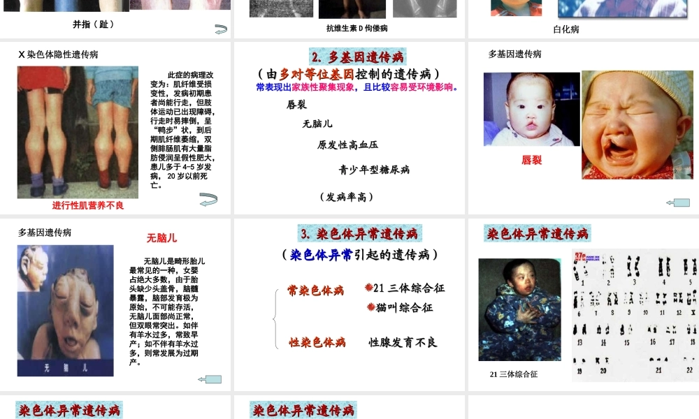 人类遗传病与优生