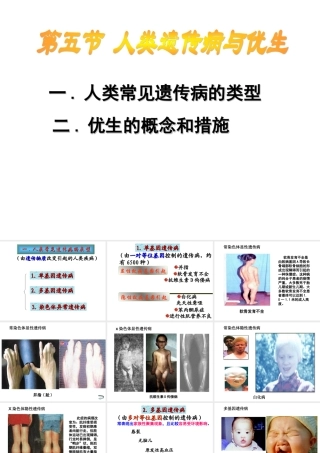 人类遗传病与优生