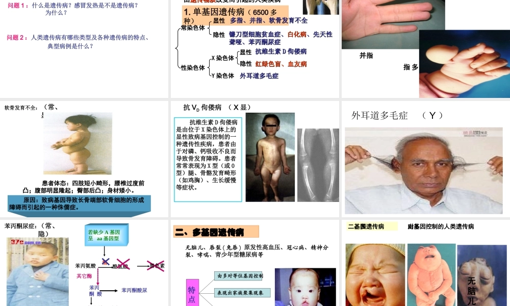 人类遗传病课件)