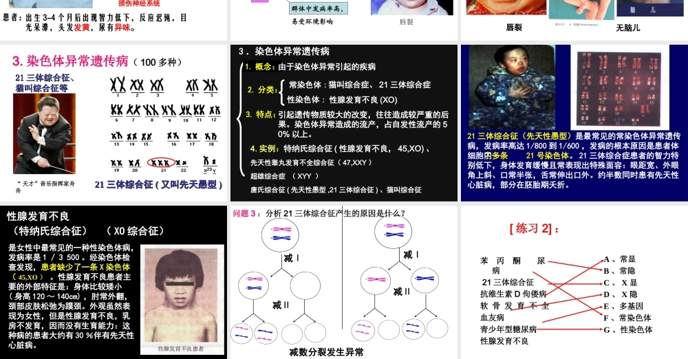 人类遗传病课件)