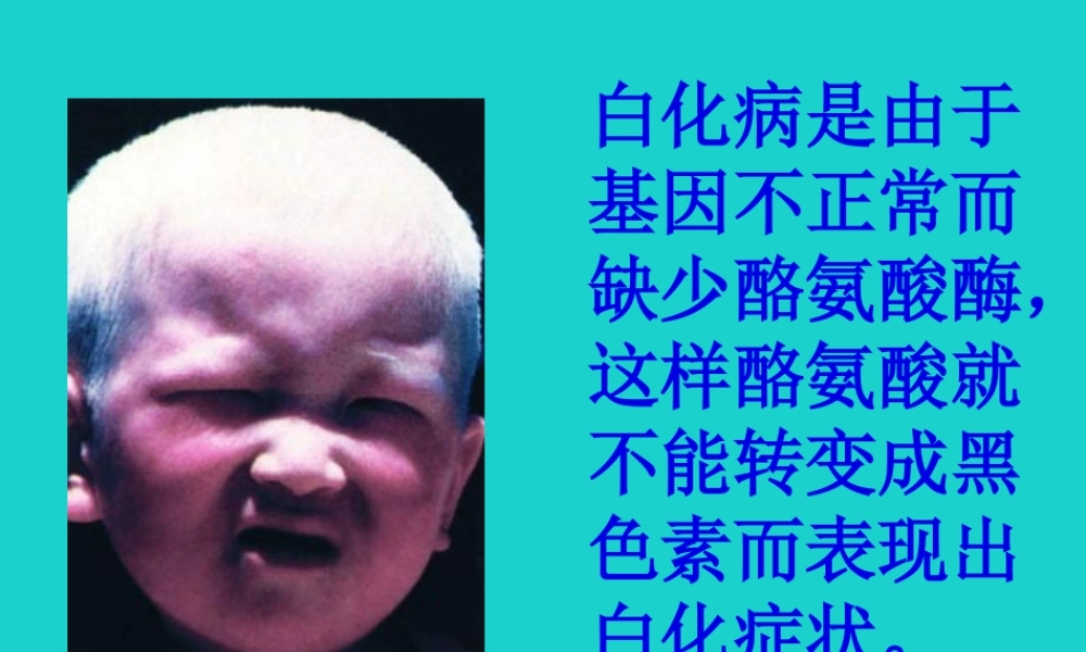 八年级生物上册 第四单元 第四章 第五节 人类优生与基因组计划 常见的遗传病课件 (新版)济南版 课件