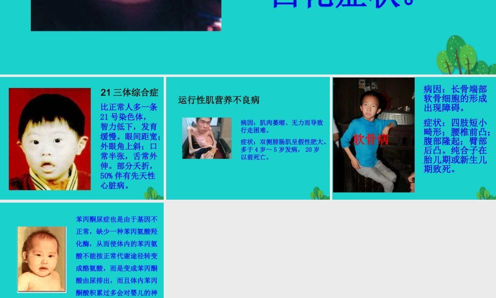 八年级生物上册 第四单元 第四章 第五节 人类优生与基因组计划 常见的遗传病课件 (新版)济南版 课件