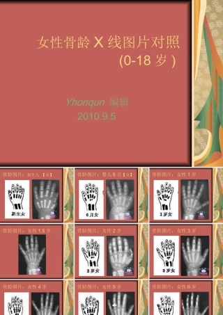 女性骨龄X线图片对照