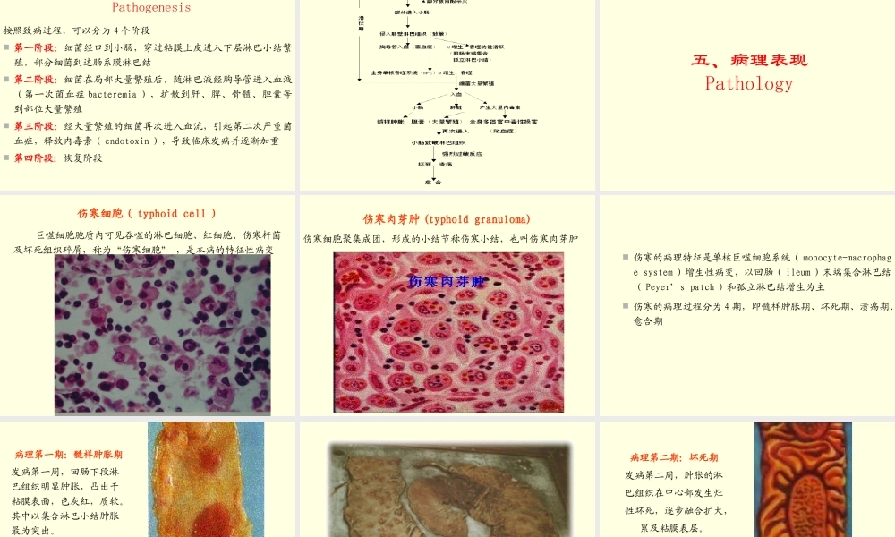伤寒与副伤寒新论
