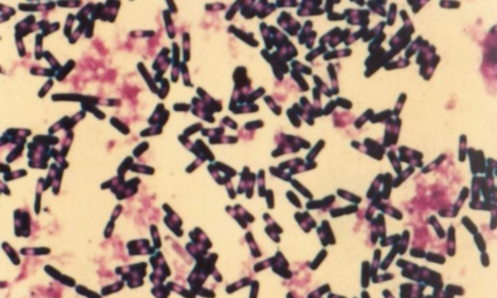八年级语文下册(细菌的启示)课件 北师大版 课件