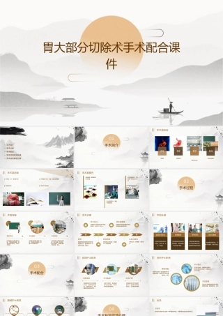 胃大部分切除术手术配合