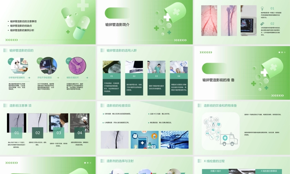 输卵管造影步骤