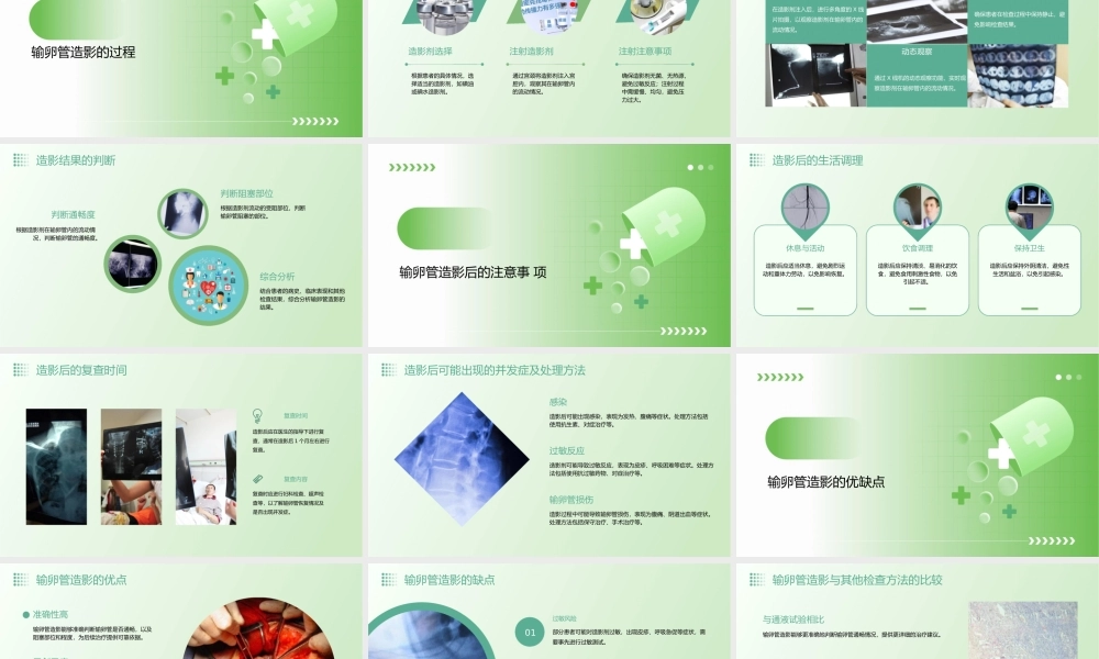 输卵管造影步骤