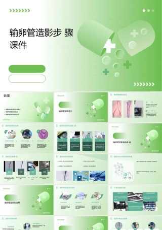 输卵管造影步骤