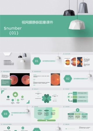 视网膜静脉阻塞