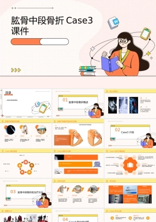 肱骨中段骨折case3