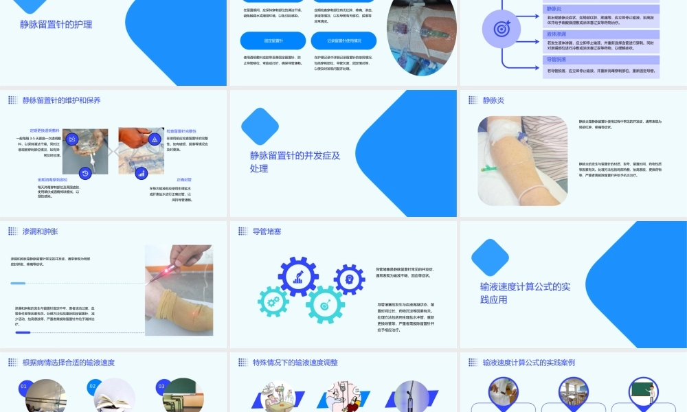 静脉留置针及输液速度计算公式