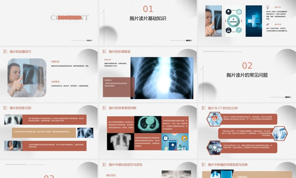 胸片读片技巧下