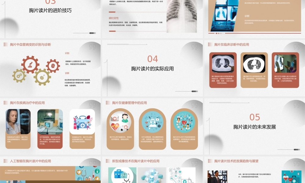 胸片读片技巧下