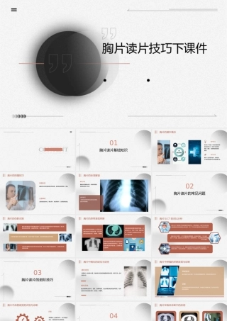 胸片读片技巧下