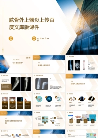 肱骨外上髁炎上传百度文库版