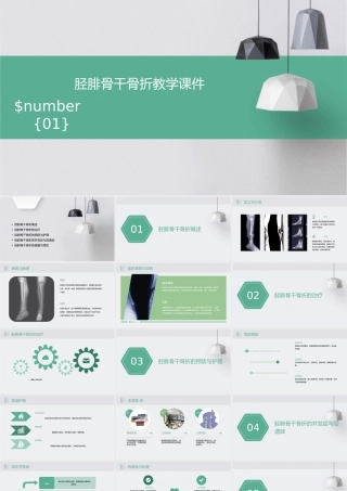 胫腓骨干骨折教学