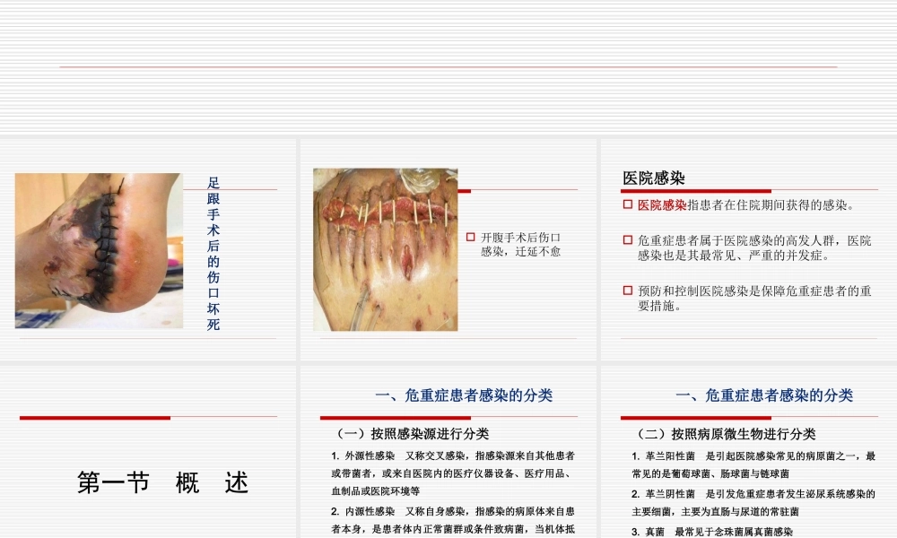 危重症患者的感染控制