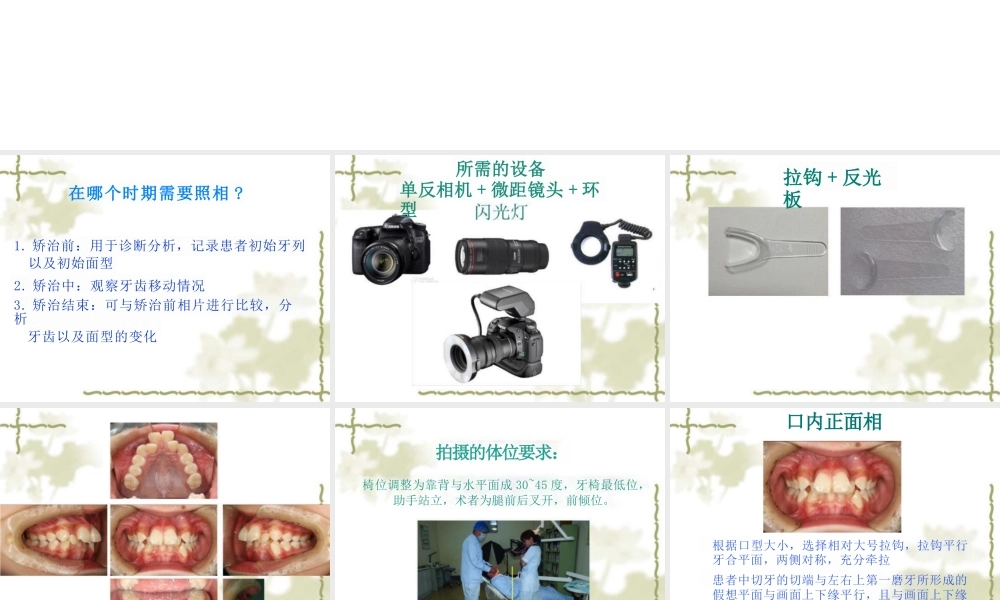 最新口腔正畸摄相幻灯片课件