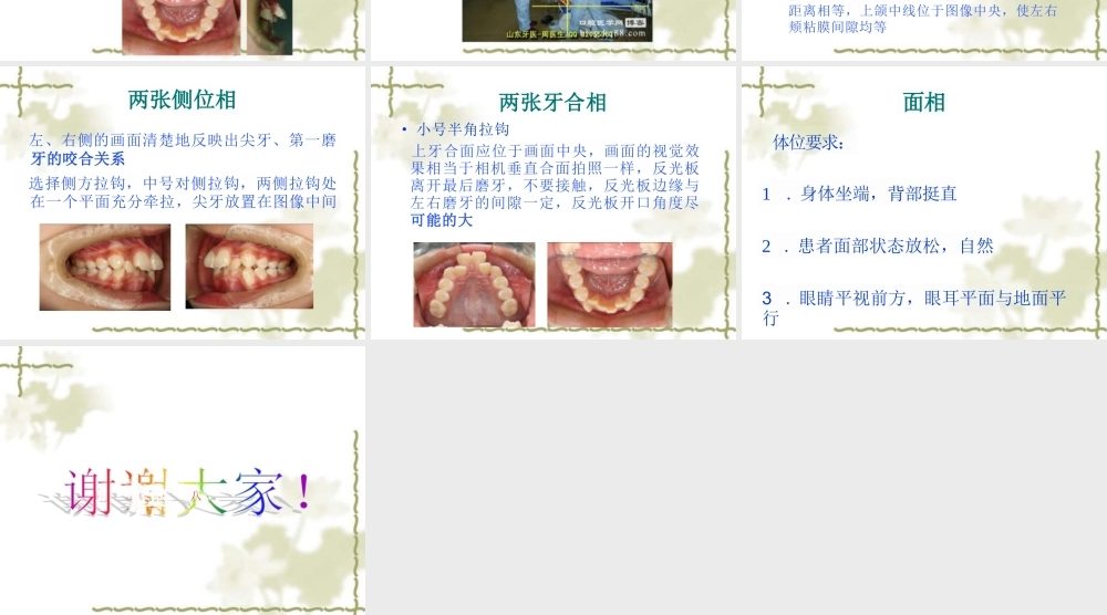 最新口腔正畸摄相幻灯片课件