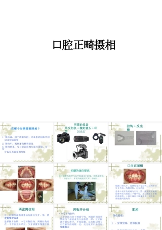 最新口腔正畸摄相幻灯片课件