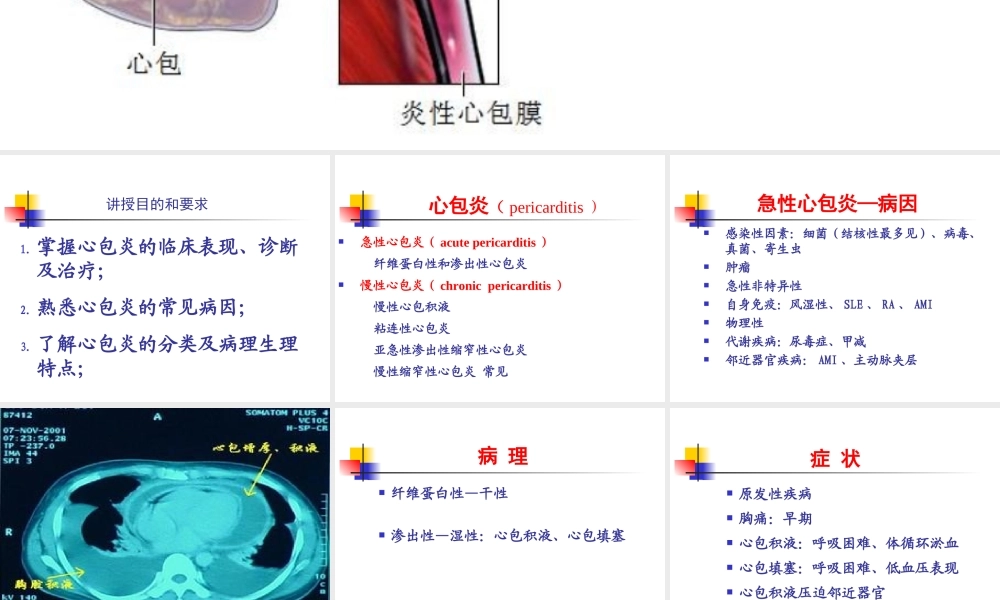 循环系统疾病-心包疾病